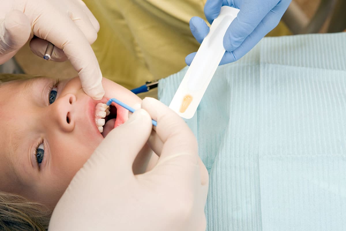 Child getting fluoride treatment image