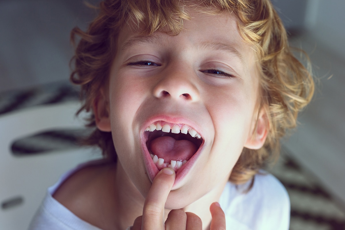 Child knocked out a tooth what to do in a dental emergency blog