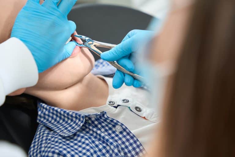 Child Tooth Extraction Recovery Tips - Great Marsh Pediatric Dentistry