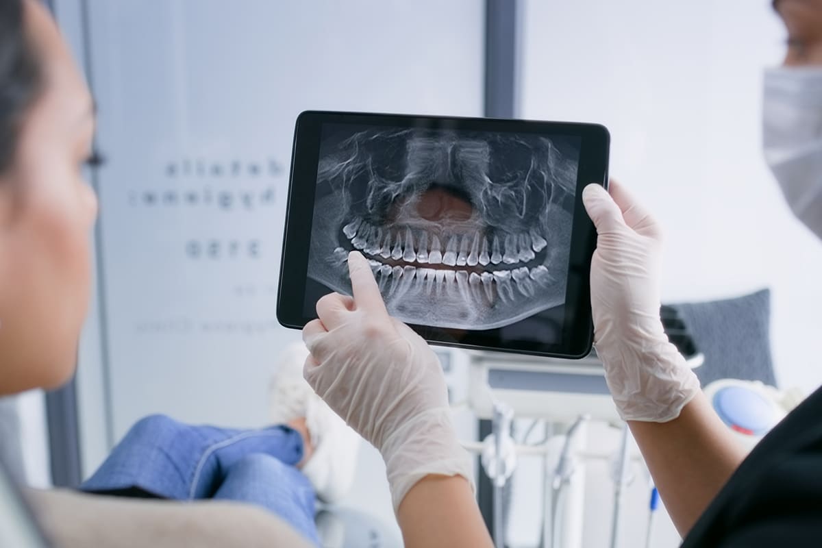 Dental x rays for kids safe or risky a parents guide blog